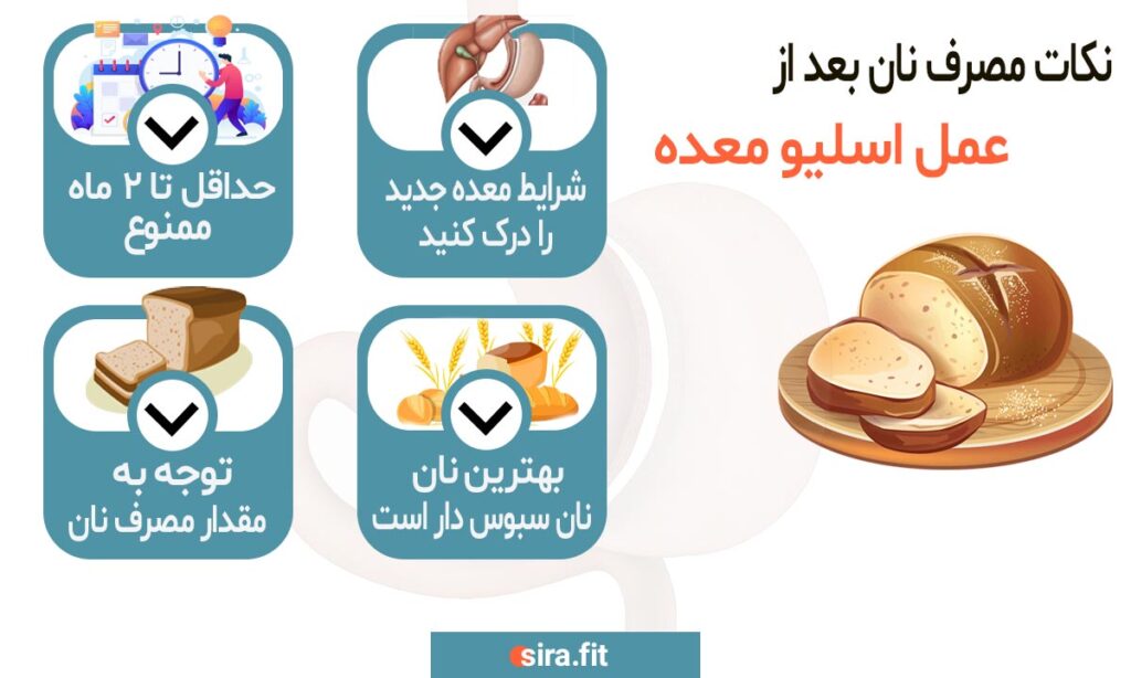 مصرف نان بعد از عمل اسلیو